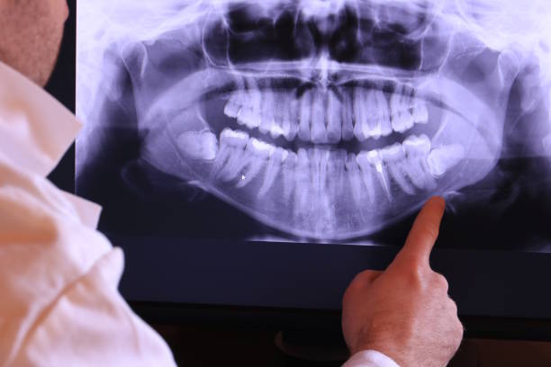 Best Emergency Dental Surgery in Brodheadsville, PA